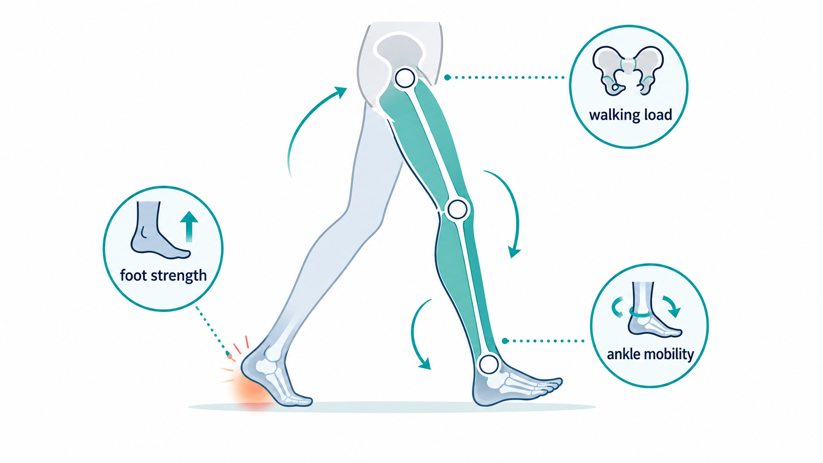 Illustration showing foot strength, ankle mobility, and walking load as part of heel pain physical therapy